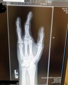 Ouch! *Is there a word for that?